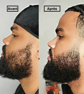 MONSIEUR Beard & Hair Grow - 3 Months - Madame La Présidente